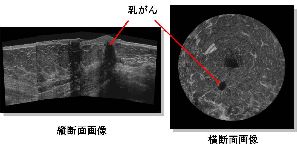 「超音波の医用応用技術」